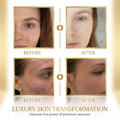 Retinol Snake Venom Gold Peeling Mask – Luxe Pore Purifying Treatment