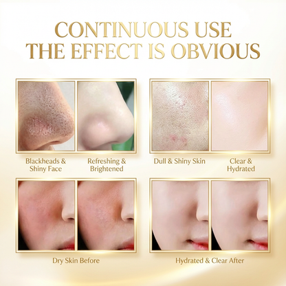 Retinol Snake Venom Gold Peeling Mask – Luxe Pore Purifying Treatment